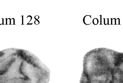 Columnata, Lower cheek teeth