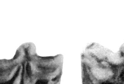 Columnata, Upper cheek teeth